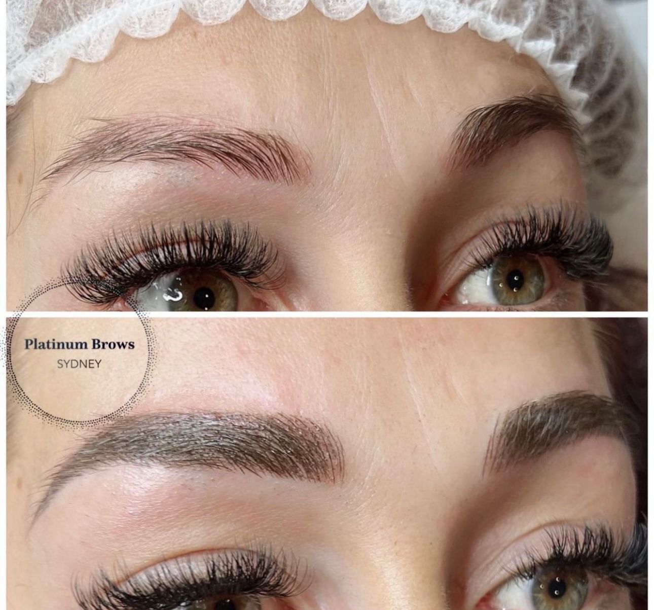 Brow 1
