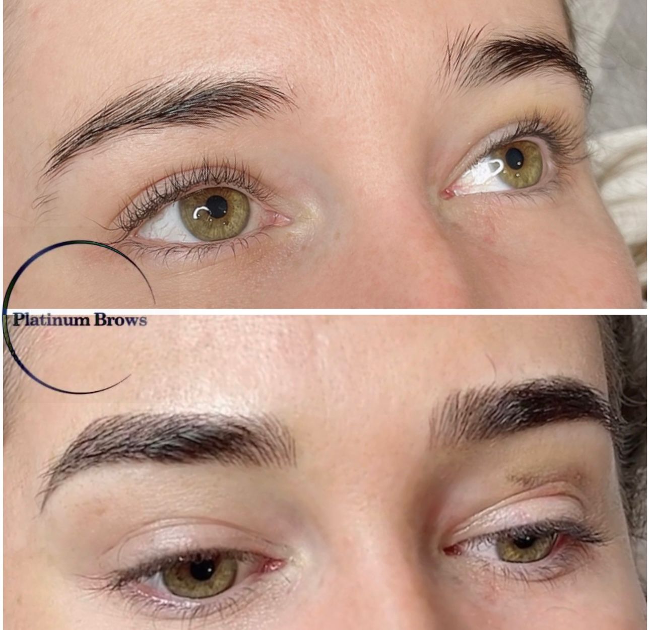 Brow 2