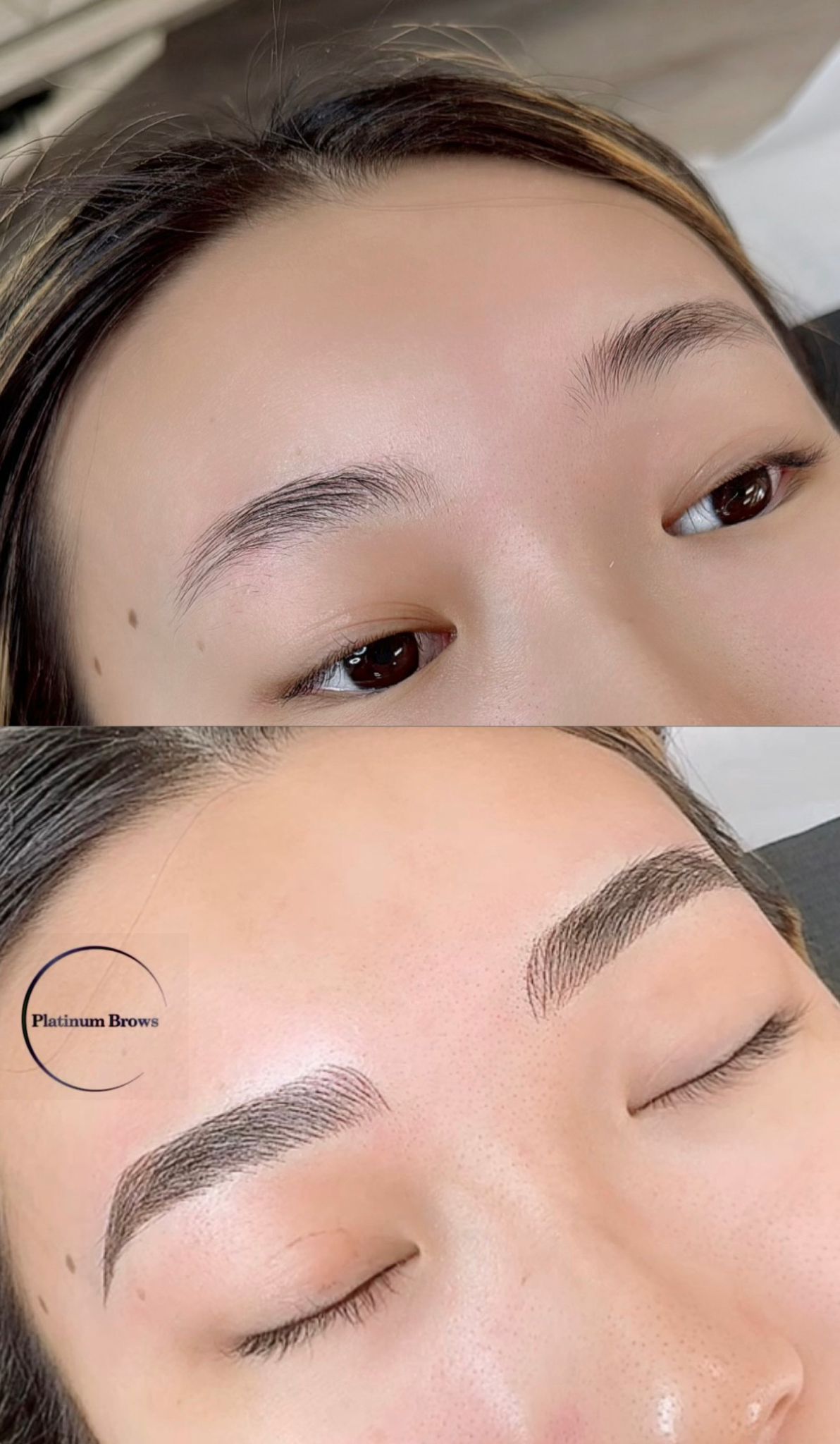 Brow 3
