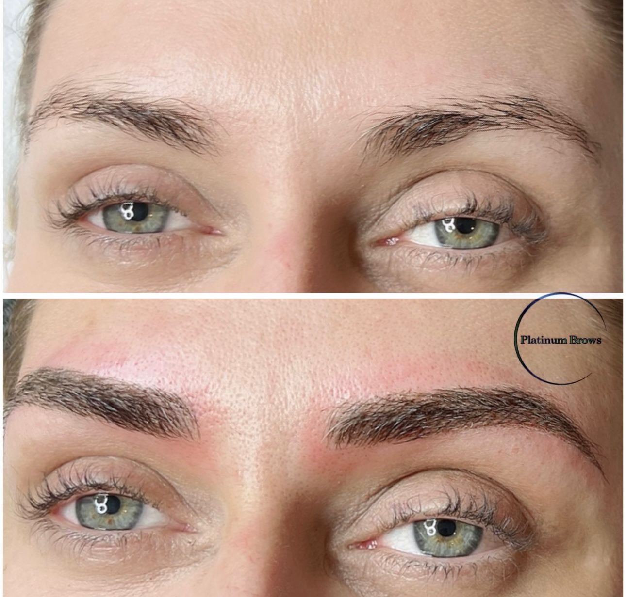 Brow 4
