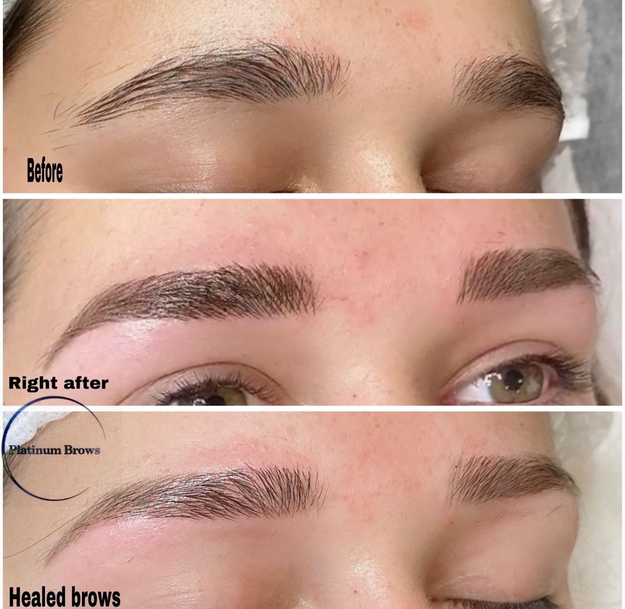 Brow 5