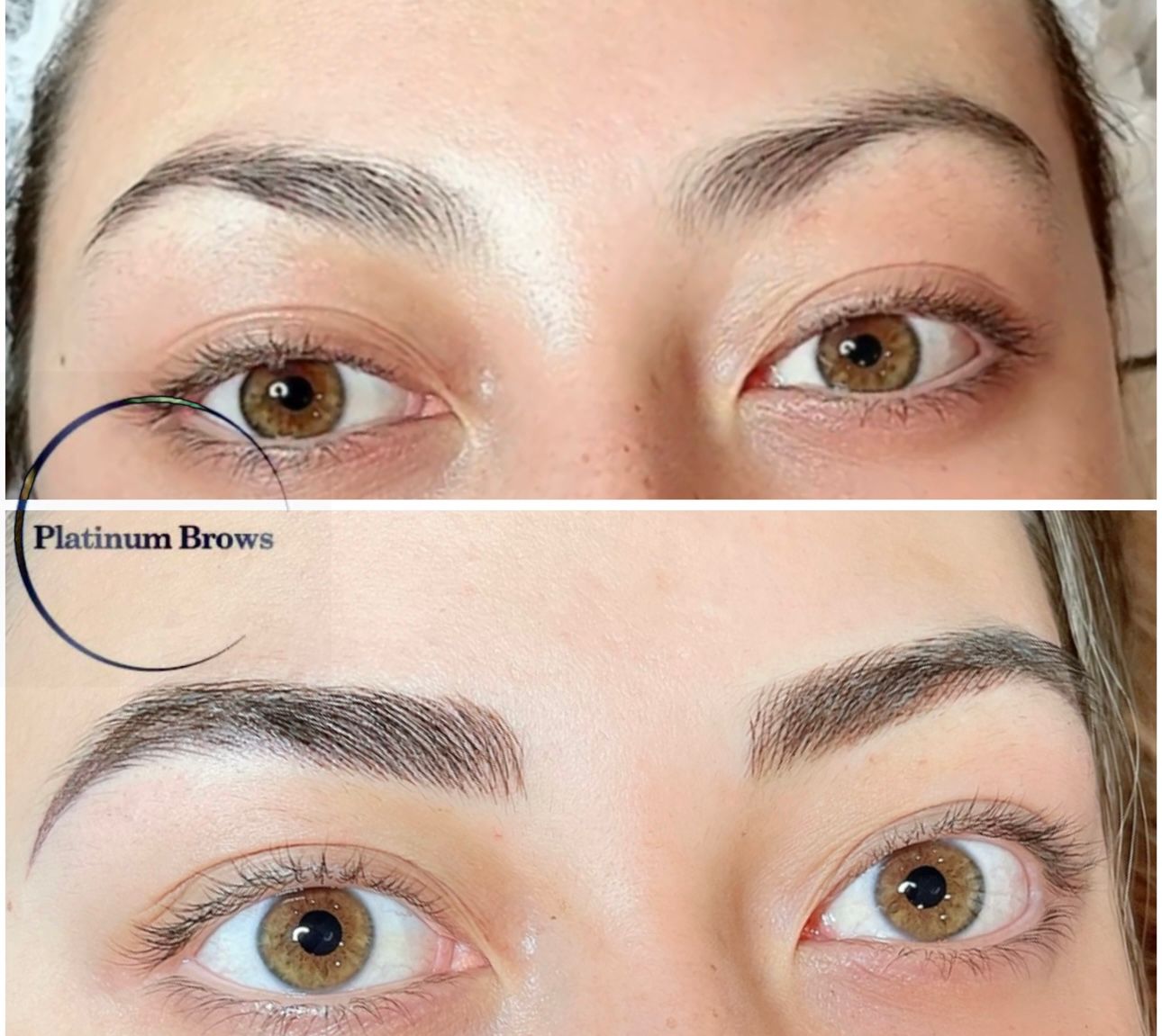 Brow 6