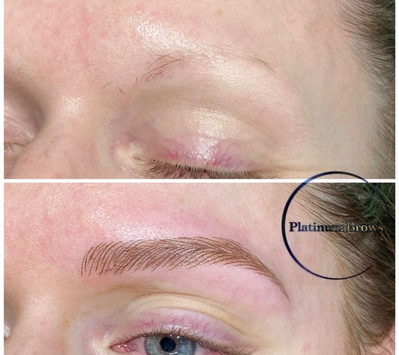 Brow 7